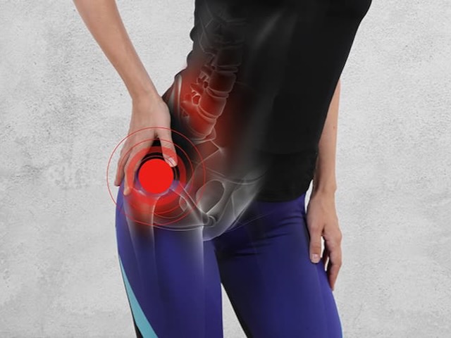 an anatomical image showing lateral pain caused by gtps