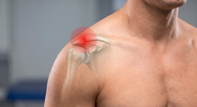 site of pain in ac joint dysfunction