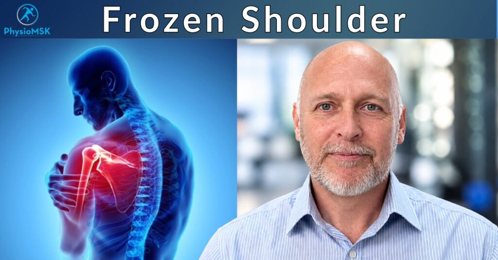 Illustration of frozen shoulder (adhesive capsulitis) anatomy, with specialist MSK physiotherapist Stephen Bunting