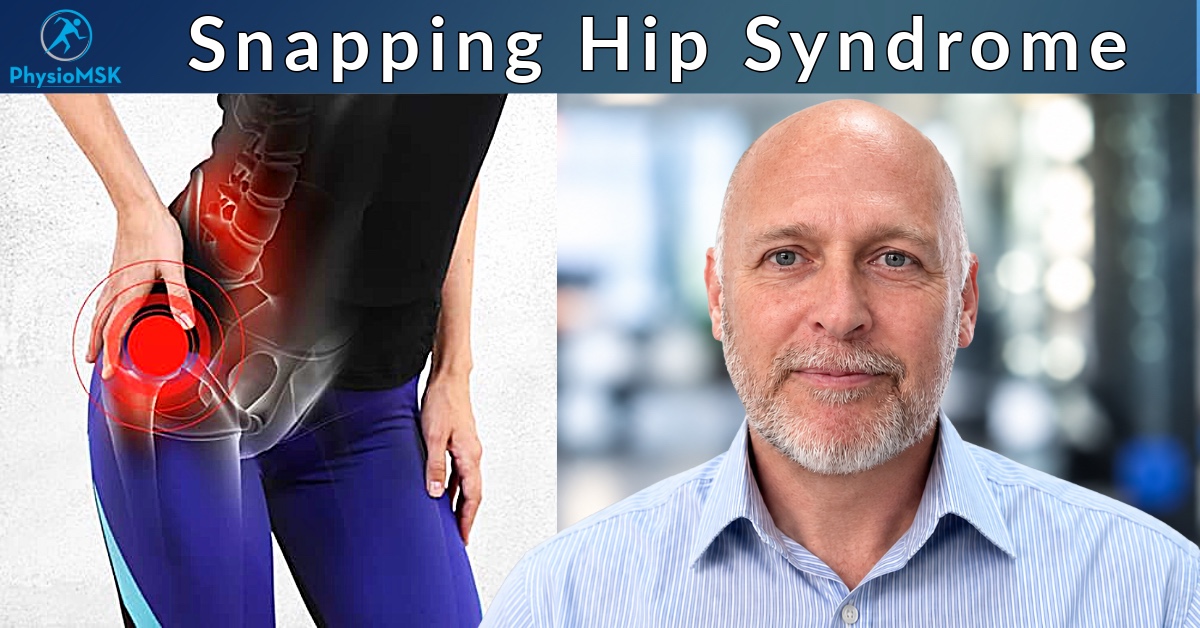 Illustration of snapping hip syndrome (internal and external), with specialist MSK physiotherapist Stephen Bunting