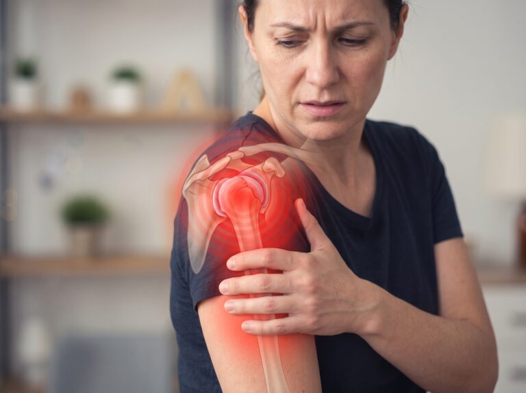 An image showing shoulder subacromial pain / rotator cuff pain / impingement